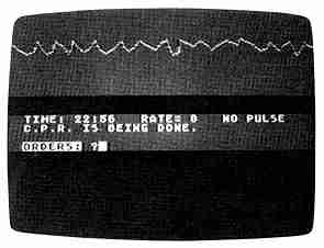 Cardiac Arrest screen
